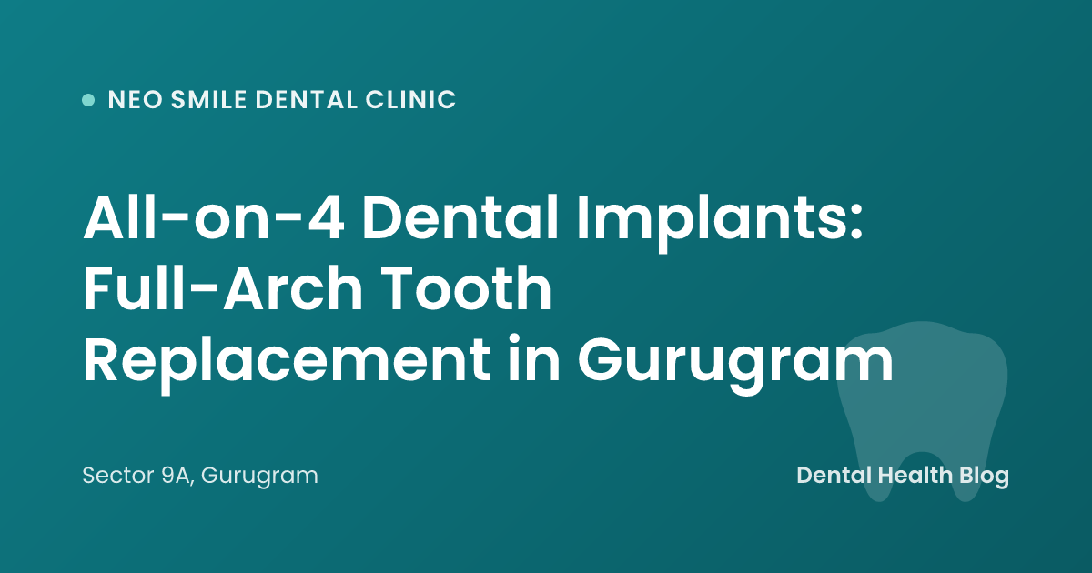 All-on-4 Dental Implants: Full-Arch Tooth Replacement in Gurugram