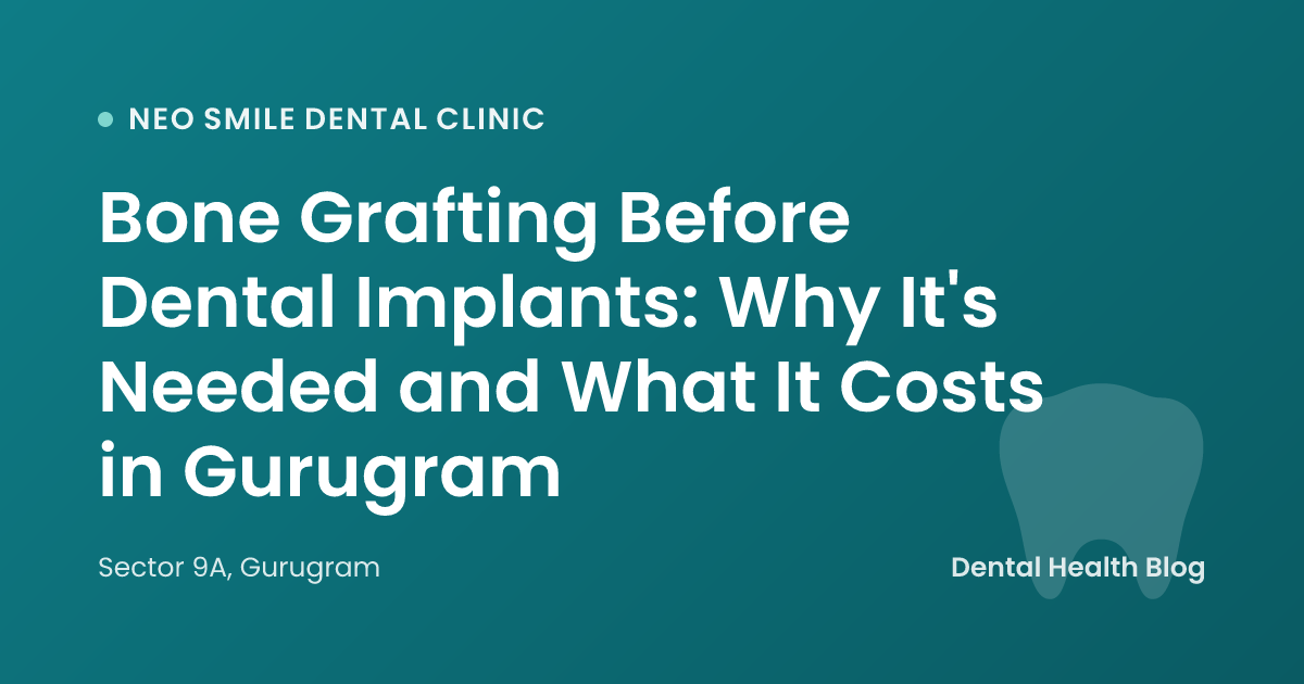 Bone Grafting Before Dental Implants: Why It's Needed and What It Costs in Gurugram