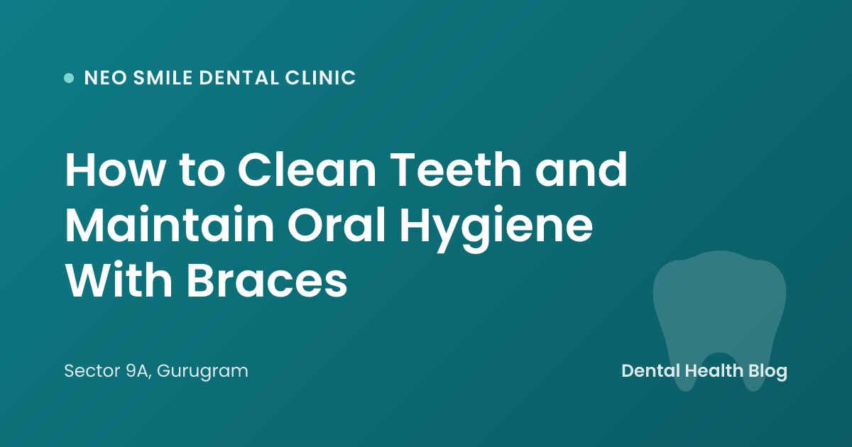 How to Clean Teeth and Maintain Oral Hygiene With Braces