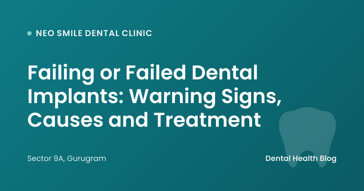 Failing or Failed Dental Implants: Warning Signs, Causes and Treatment