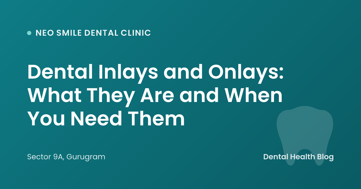 Dental Inlays and Onlays: What They Are and When You Need Them