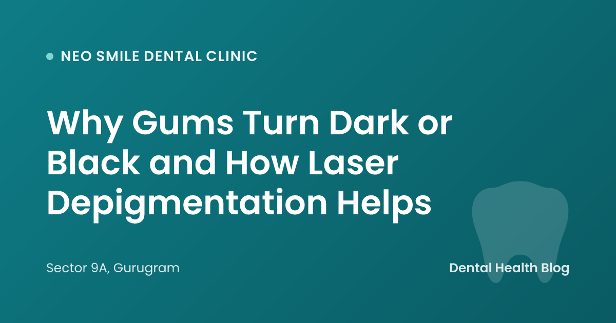 Why Gums Turn Dark or Black and How Laser Depigmentation Helps