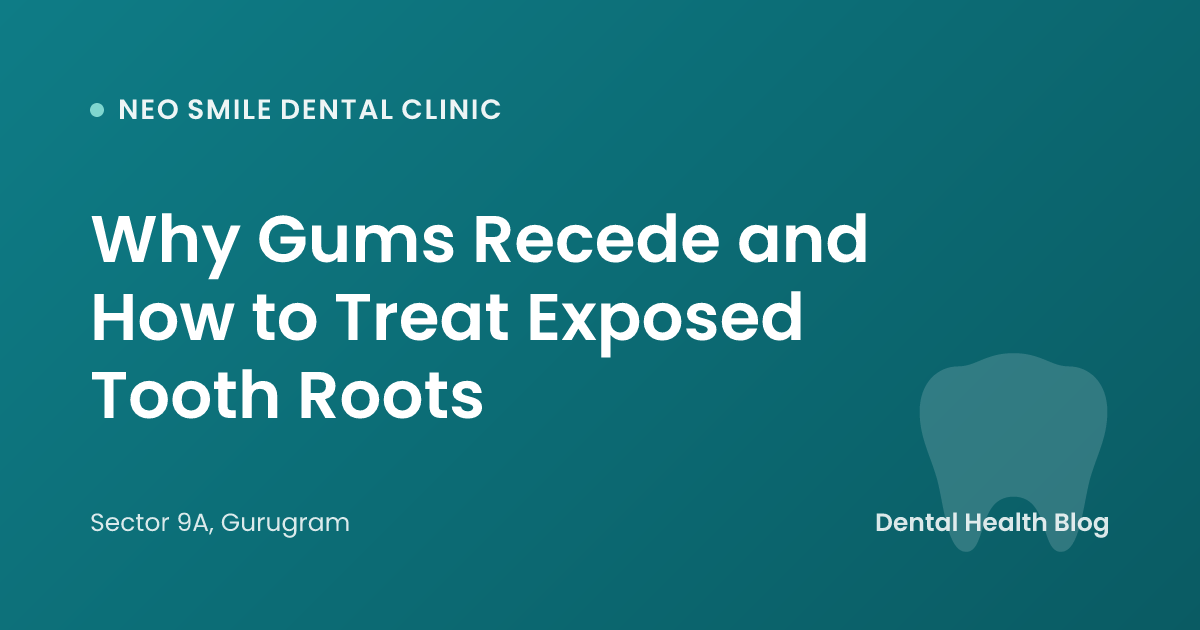 Why Gums Recede and How to Treat Exposed Tooth Roots