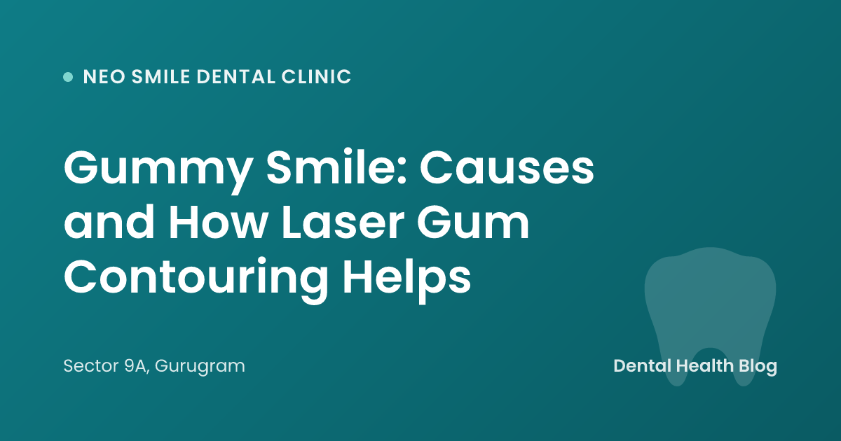Gummy Smile: Causes and How Laser Gum Contouring Helps