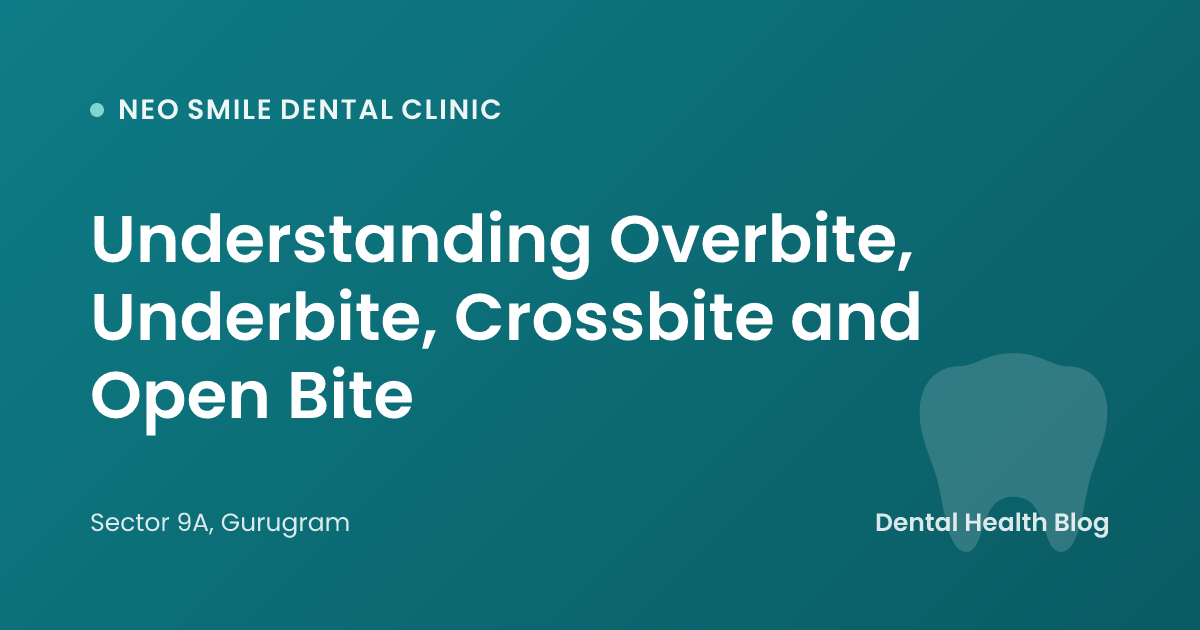 Understanding Overbite, Underbite, Crossbite and Open Bite
