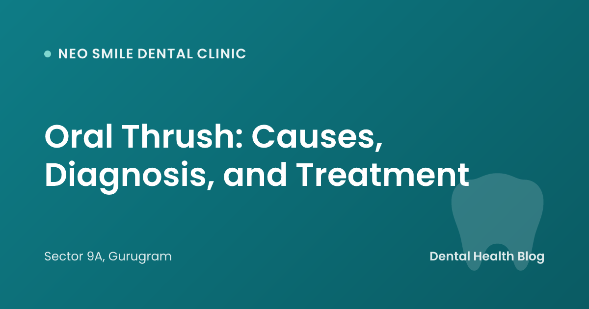 Oral Thrush: Causes, Diagnosis, and Treatment