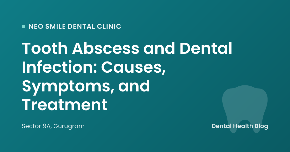 Tooth Abscess and Dental Infection: Causes, Symptoms, and Treatment