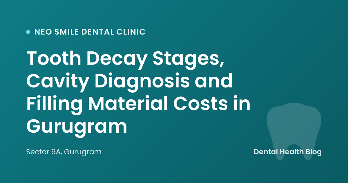 Tooth Decay Stages, Cavity Diagnosis and Filling Material Costs in Gurugram